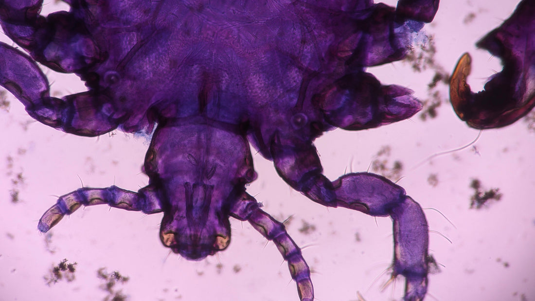 The Parasite Of The Human Spirit - The Struggle To Continue Forth In Our Lives